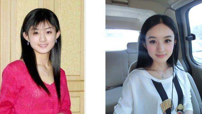 赵丽颖整容了吗 赵丽颖的男朋友是谁
