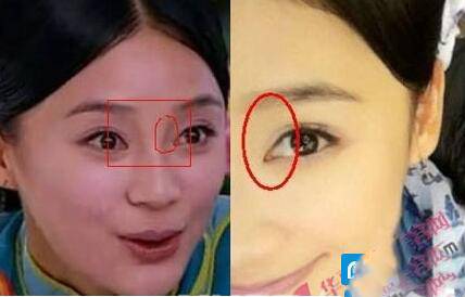 揭袁姗姗整容前后照片 与杨幂美貌事业大PK