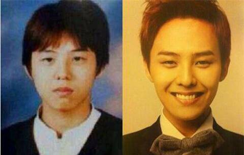 崔胜贤整容前后照片对比 Bigbang成员整容