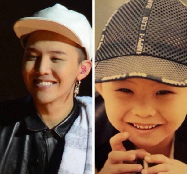 崔胜贤整容前后照片对比 Bigbang成员整容