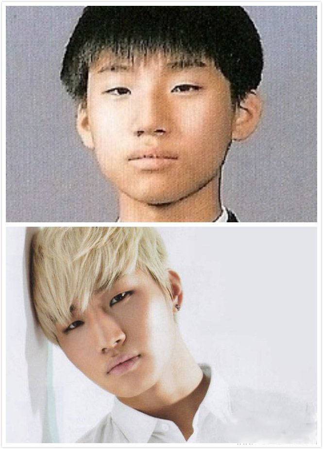 崔胜贤整容前后照片对比 Bigbang成员整容