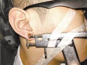 男子打耳洞却遭耳钉枪夹住 男子称留下阴影不敢打了