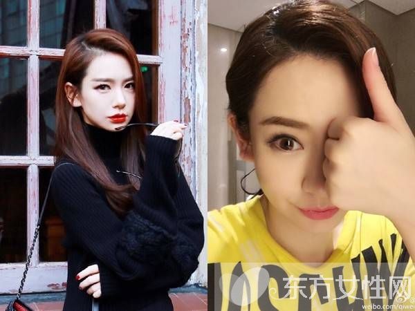 戚薇日本拍戏受伤 需做面部缝针手术