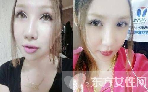 徐弯弯微博爆料黄海波嫖娼视频 整容前模样惊人