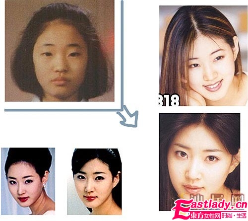 金莎朗整容前后对比照 金莎朗整容了吗