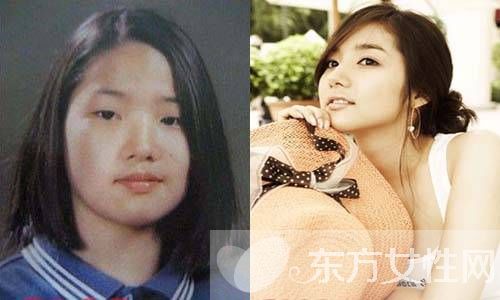 朴敏英整容前后照曝光 朴敏英三次大变身