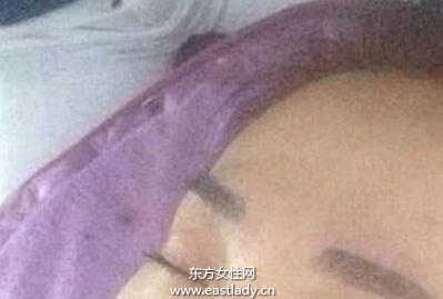 丫蛋整容前后对比照曝光