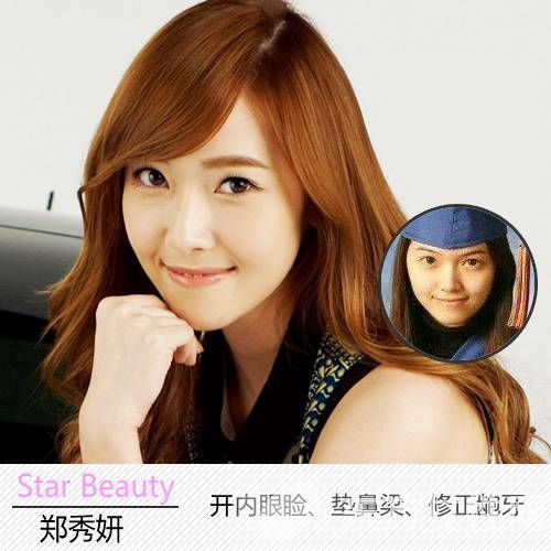 郑秀妍个人资料 郑秀妍整容前后照曝光