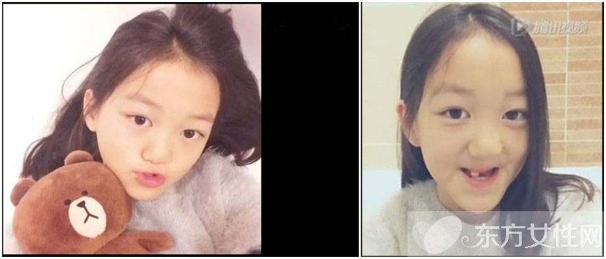 李嫣兔唇原因 李嫣护姐对抗网友获赞 中国好姐妹