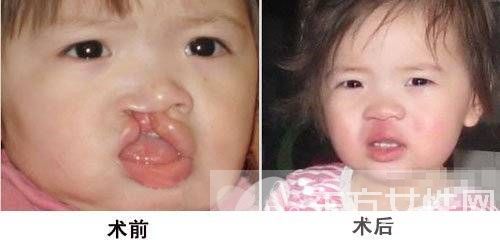 李嫣兔唇原因 李嫣护姐对抗网友获赞 中国好姐妹