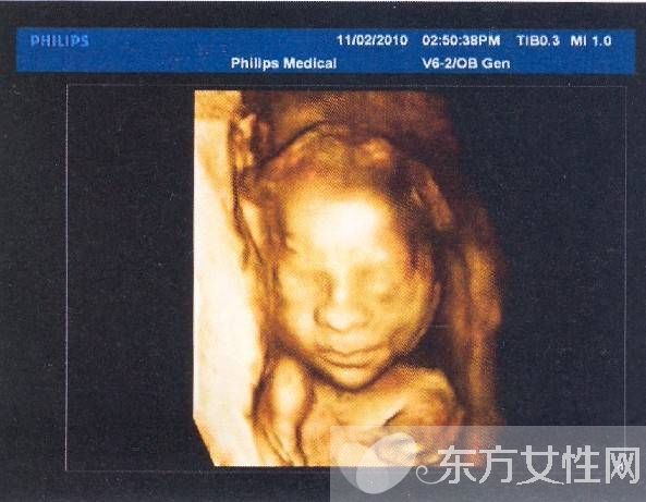 三维b超什么时候做 这些B超误区有多少妈妈知道