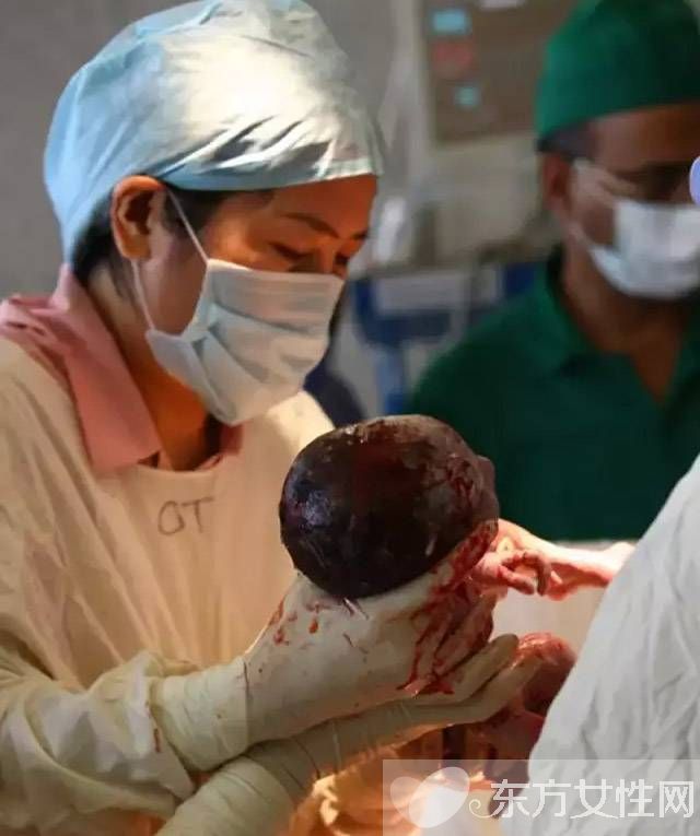 产妇分娩中都有哪些意外发生 这些应急措施要牢记