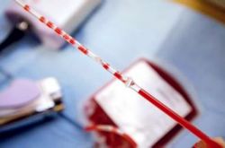 脐带血有必要保存吗 脐带血别扔可以救命的