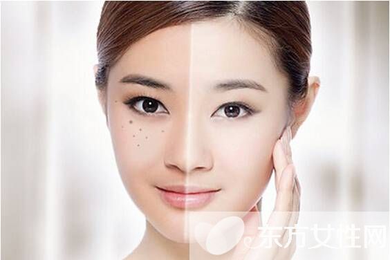 产后黄褐斑怎么去掉 这些方法试过的都说好