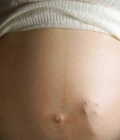 胎动频繁要注意 当心宝宝会 缺氧