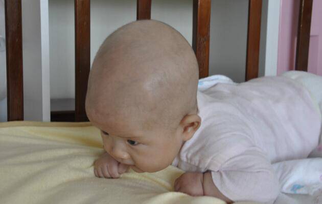 为什么婴儿要练习抬头 训练抬头需注意