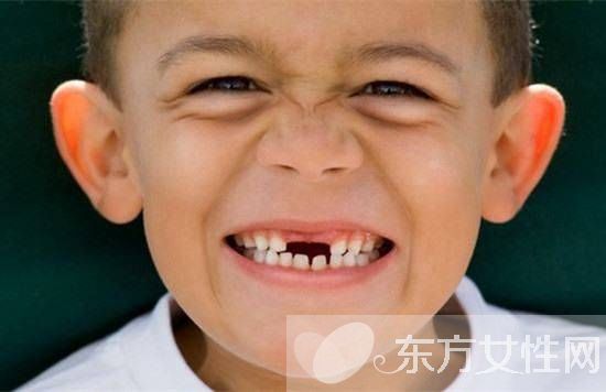 儿童换牙顺序图 儿童换牙一定要注意这些方面
