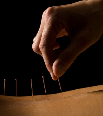 针灸减肥 针灸减肥十大常见问题