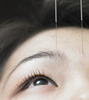 针灸减肥 针灸减肥十大常见问题