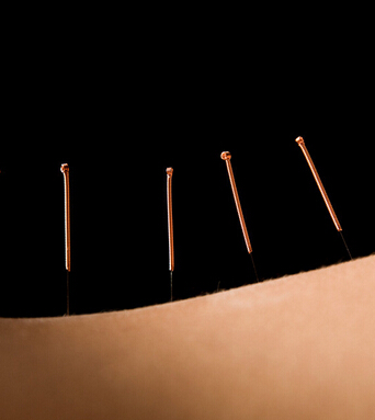 针灸减肥 针灸减肥十大常见问题