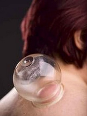 拔罐减肥 中医详解拔罐操作方法及注意事项