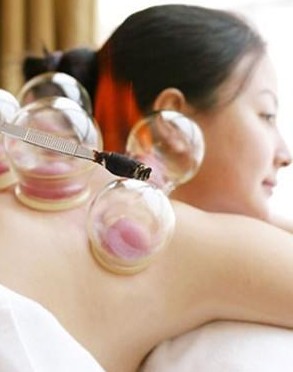 拔罐减肥方法 拔罐减肥的禁忌及注意事项