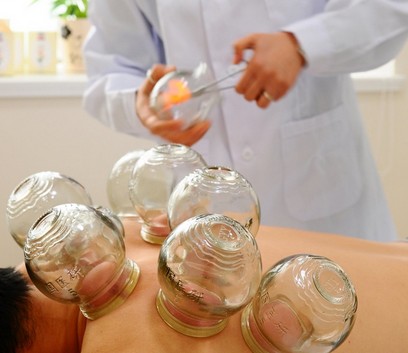 拔罐减肥的方法 拔罐减肥的作用和操作方法