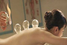 拔罐减肥的方法 拔罐减肥的作用和操作方法