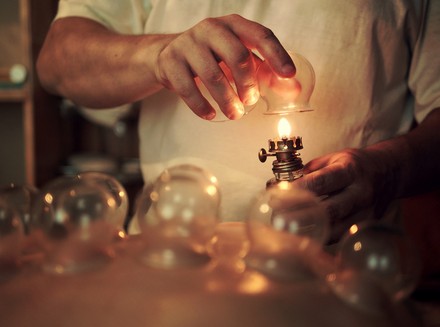 拔罐减肥 拔罐减肥的利与弊