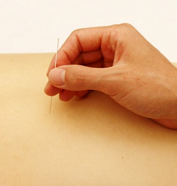 针灸减肥的原理 调整内分泌失调