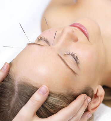 针灸的减肥原理 调整身体代谢功能