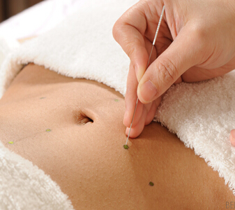 埋线减肥需辨体质 什么人适合做埋线减肥