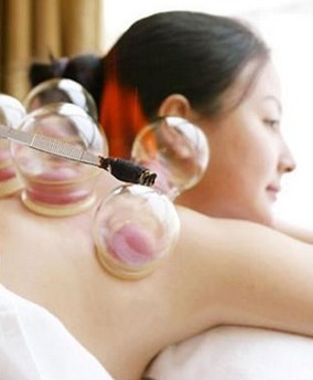 拔罐减肥方法 拔罐减肥的作用和基本操作