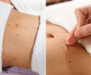 埋线减肥初试者 需严守4大注意事项