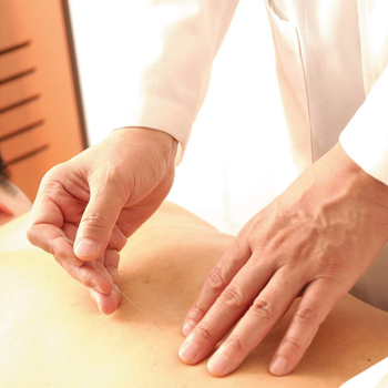 针灸如何减肥 针灸减肥的原理及功效