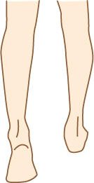 减肥跟体温有关系 轻松减肥告别下半身肥胖