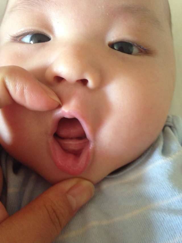 宝宝长牙顺序很关键 家长千万别错过