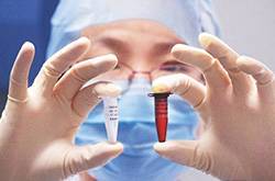 什么是流脑疫苗 流脑疫苗的接种注意事项