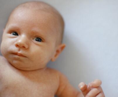 核黄疸早期四大症状 核黄疸的后遗症有哪些