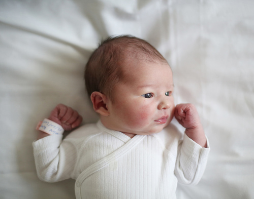 婴儿脸上起小红疙瘩 当心是过敏惹的祸