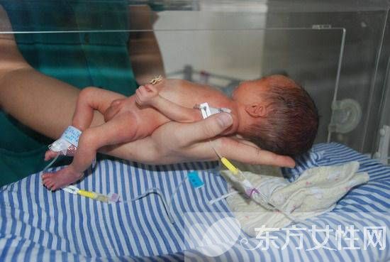 32周早产儿能存活吗 导致早产的6大因素