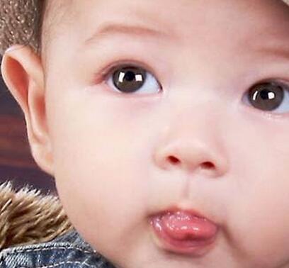 宝宝缺锌的症状是怎样的 宝宝会有哪些表现