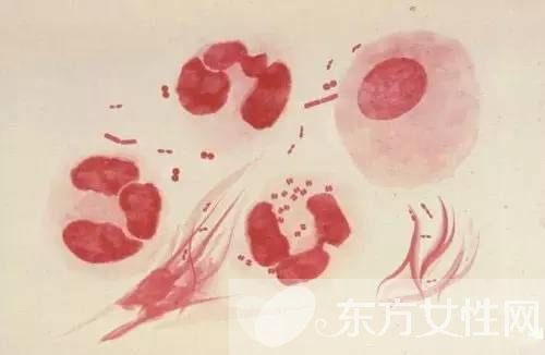 脑膜炎有什么症状 脑膜炎是什么原因引起的