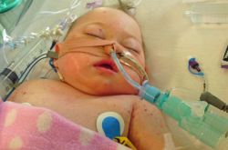 脑膜炎有什么症状 脑膜炎是什么原因引起的