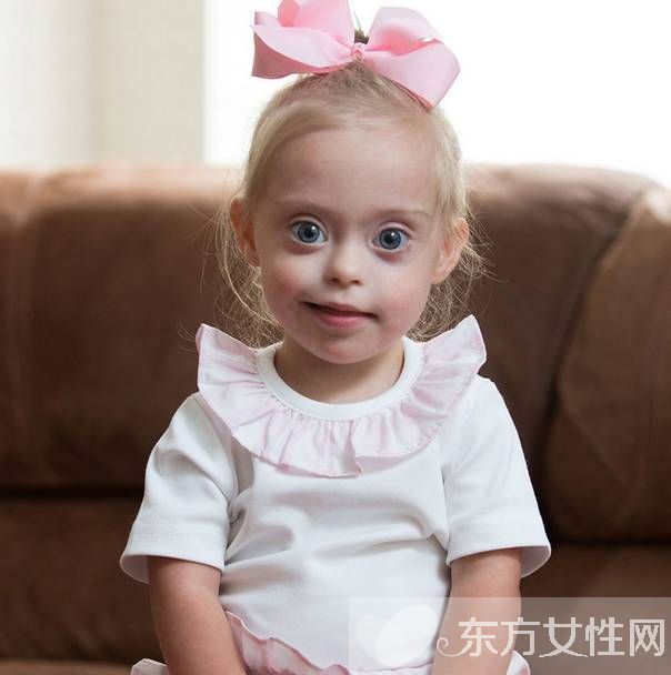唐氏综合症是什么 如何有效预防宝宝唐氏综合症
