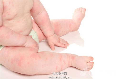 预防宝宝过敏 误区大破解