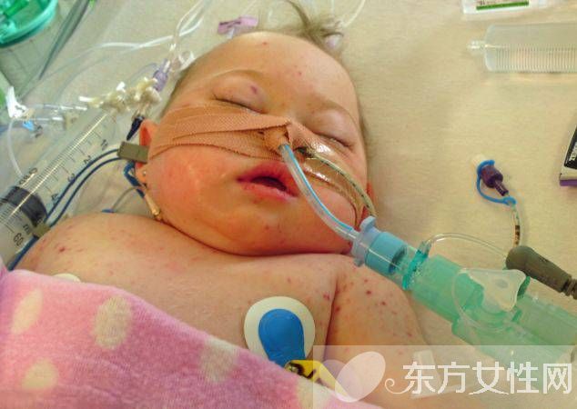 脑膜炎有什么症状 脑膜炎是什么原因引起的