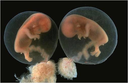 引发葡萄胎形成原因 4种高发人群需注意