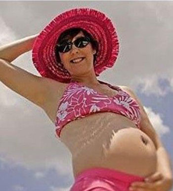 孕期皮肤粗糙敏感 孕妇如何护理皮肤