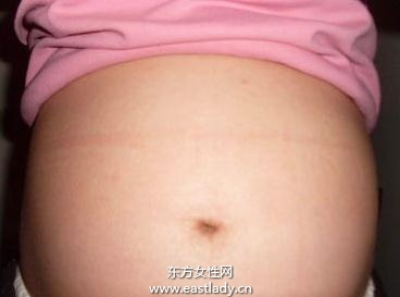 太阳对胎宝宝性别的干扰